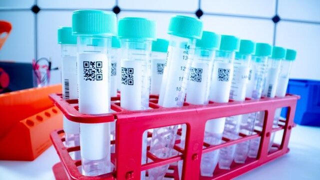 قیمت‌های مجاز تست کرونا در آزمایشگاه‌ها