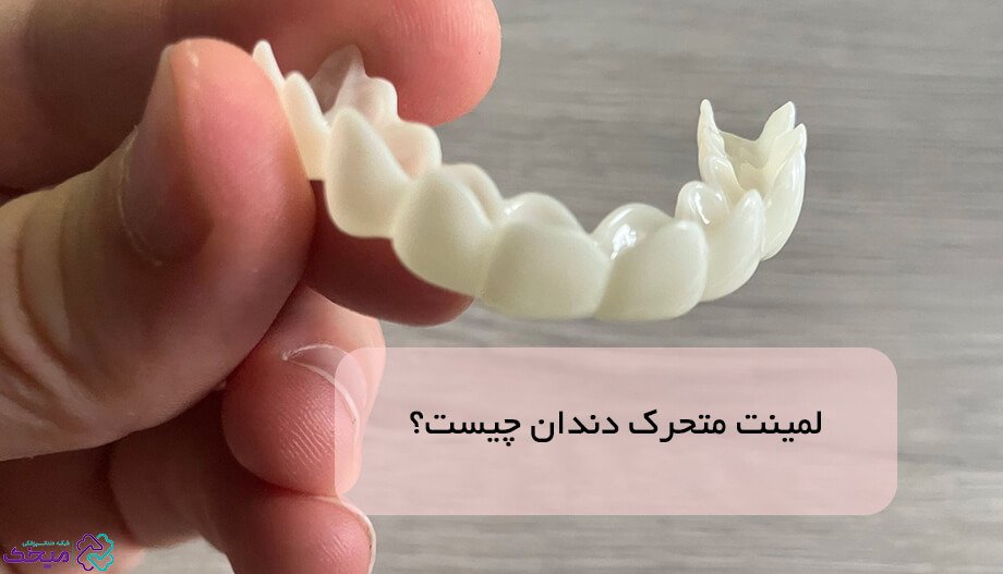 لمینت متحرک دندان؛ انواع و کاربردهای آن